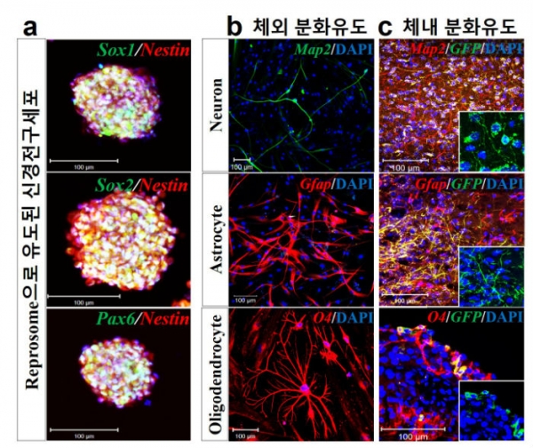 엑소좀(리프로좀)에 의한 고효율 신경전구세포 직접교차분화 유도