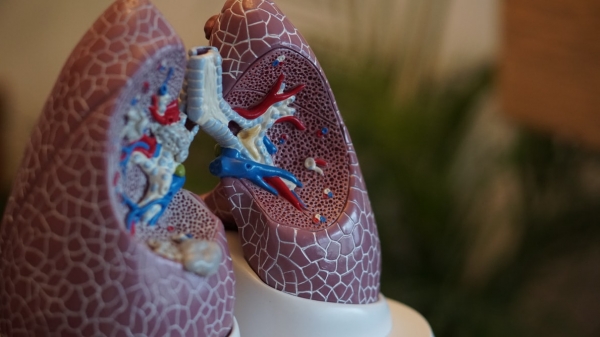 폐섬유화증은 한 번 발병하면 치료법을 찾기 어렵다. 국내 연구진이 폐섬유화증 진단과 치료에 사용할 수 있는 인체 단백질을 발견하고 그 기전을 분석하는데 성공했다. 사진은 폐 모형을 촬영한 이미지 컷. Unsplash 제공.