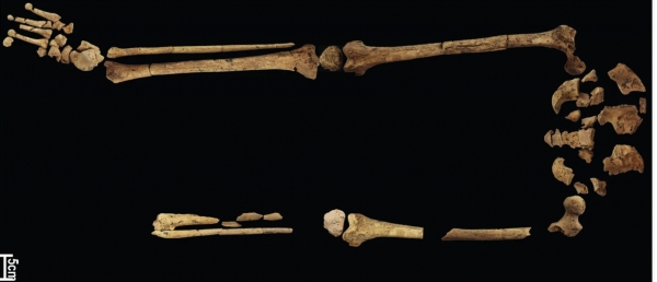 연구진이 인도네시아 동굴에서 발견한 시체의 다리뼈 한 쪽이 절단돼 있다. 출처=네이처