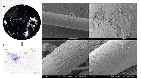 (A)지중해 북서부 연안에서 채집한 극세사의 광학현미경 사진  (B)극세사의 세균 군집 주사전자현미경(SEM) 이미지  (C-F)길쭉하고 둥근 세균들의 세포들이 끈적한 분자화합물로 생물막을 형성한 모습. 출처=PLOS ONE
