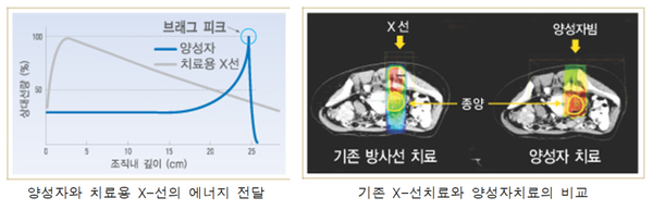 (좌) 양성자와 치료용 X-선의 에너지 전달 (우) 기존 X-선 치료와 양성자 치료의 비교 