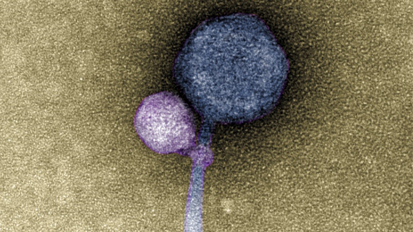 연구진이 전자현미경으로 촬영한 두 바이러스가 결합된 모습[사진=타기데 드카발호]